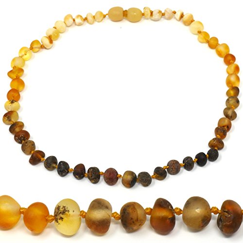 Mama Natural Amber Necklace - 12.5