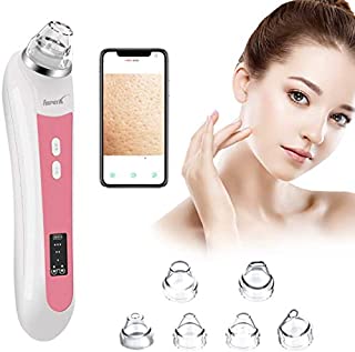 Blackhead Vacuum, AsperX 5.0 Megapixels Visible Blackhead Remover Facial Pore Vacuum, 20X Microscope Blackhead Suction Tool, Rechargeable Suction Facial Pore Cleaner with 6 Replaceable Tips(Upgraded)