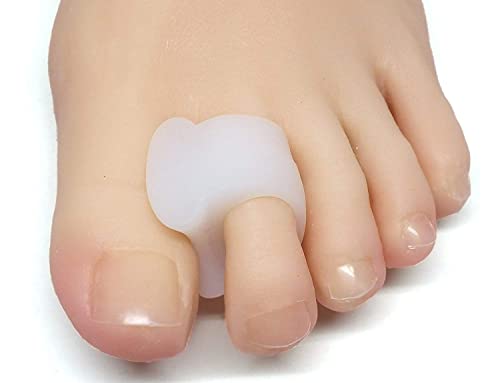 10 Best Bunion Treatments