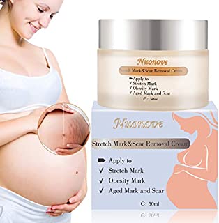 Stretch Mark Cream for Pregnancy, Stretch Mark Scar Cream, Postpartum Obesity Pregnancy Cream, Remove Stretch Marks From Pregnancy, Repair Scar Slack Line Abdomen Stretch Marks Postpartum