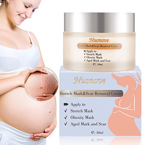 Stretch Mark Cream for Pregnancy, Stretch Mark Scar Cream, Postpartum Obesity Pregnancy Cream, Remove Stretch Marks From Pregnancy, Repair Scar Slack Line Abdomen Stretch Marks Postpartum