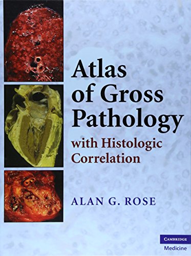 Atlas of Gross Pathology (With Histologic Correlation)