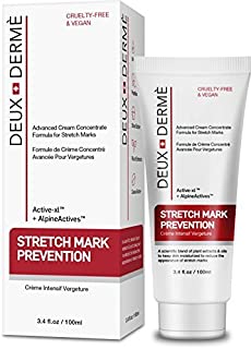 Deux Derme - Stretch Mark Prevention Cream, with Vitamin E, Cocoa Butter for Pregnancy, Weight Gain, 3.4 oz.