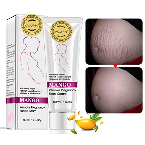 RtopR Mango Stretch Marks and Scar Cream -Stretch Marks and Scar Removal Cream for Pregnancy - Best Body Moisturizer-40g